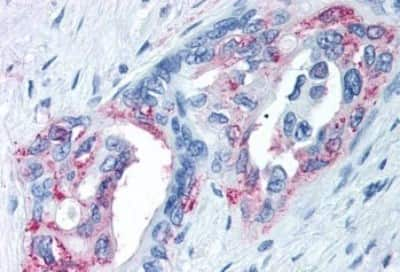 Immunohistochemistry-Paraffin: TRPM8 Antibody [NBP3-14505]